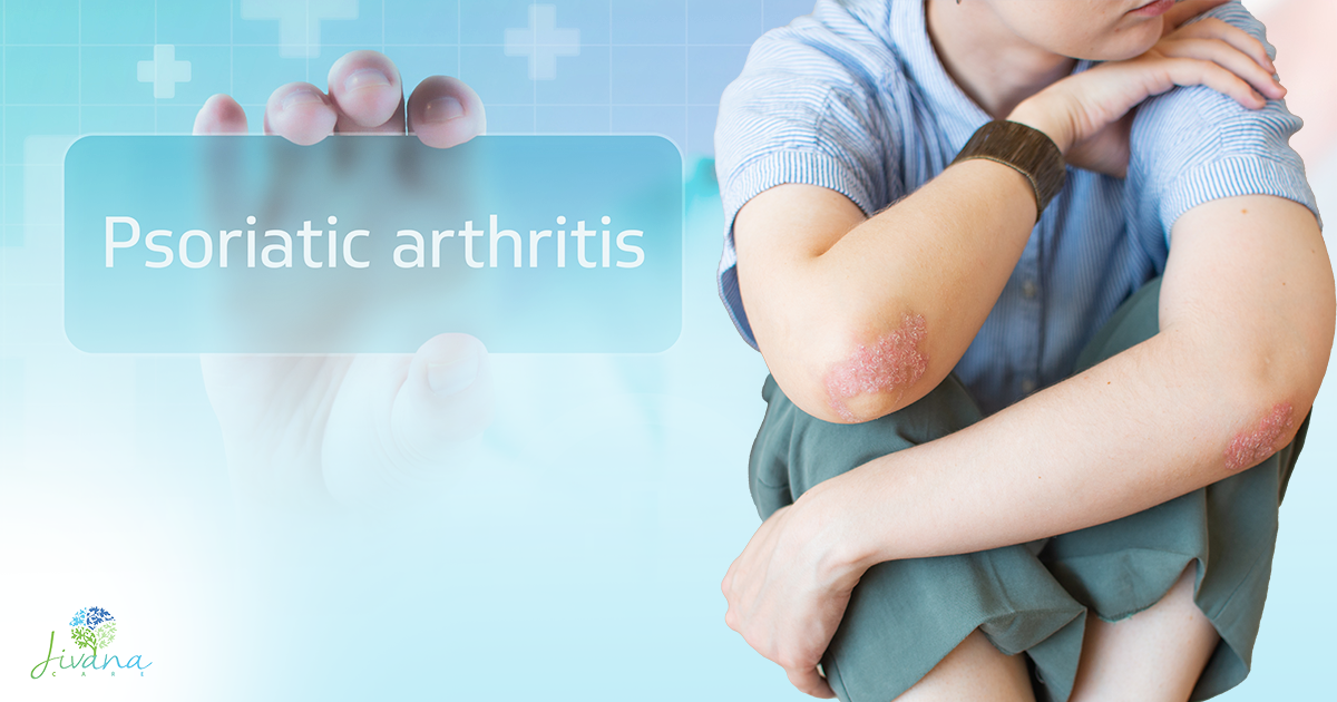 How to Determine the Right Psoriatic Arthritis Treatment Pattern for You